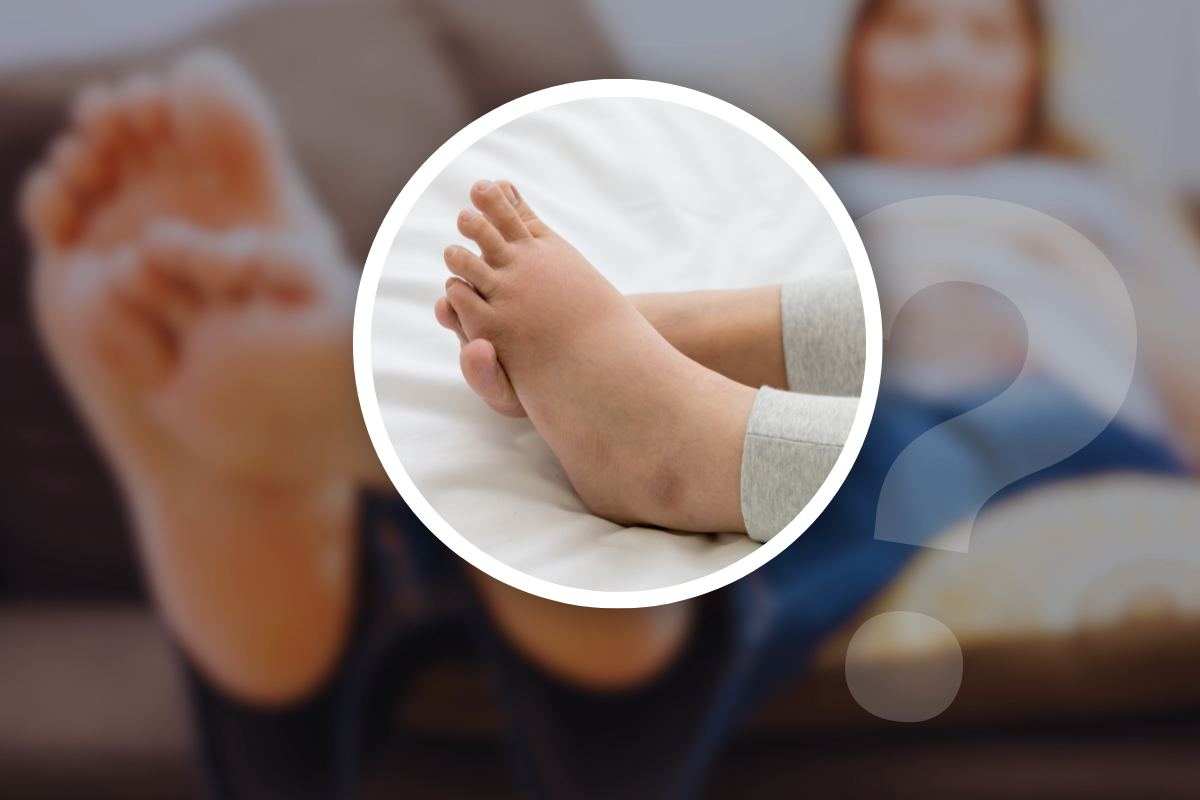 rimedi ai piedi gonfi in estate